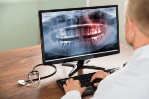 male dentist looking at dental scan