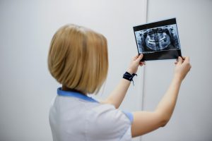 lady holding dental implant scan