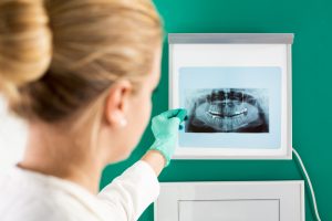 Photo of female dentist reviewing a panoramic x-ray