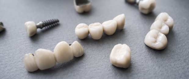 implant-retained dentures and traditional